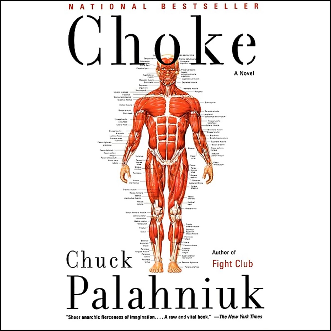 Choke